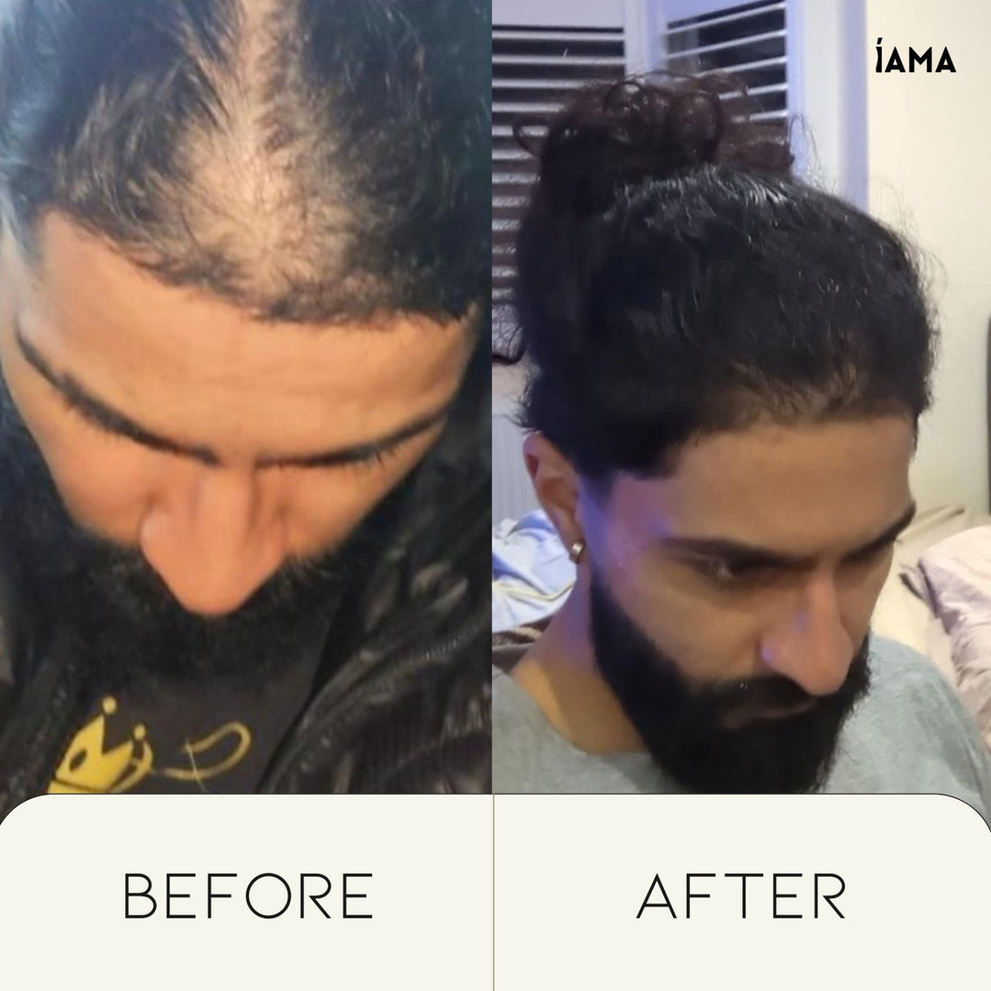 How-Castor-Oil-Helps-With-Hair-Loss-and-Balding-In-Men iAMA