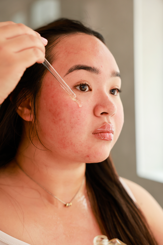 Castor Oil For Rosacea