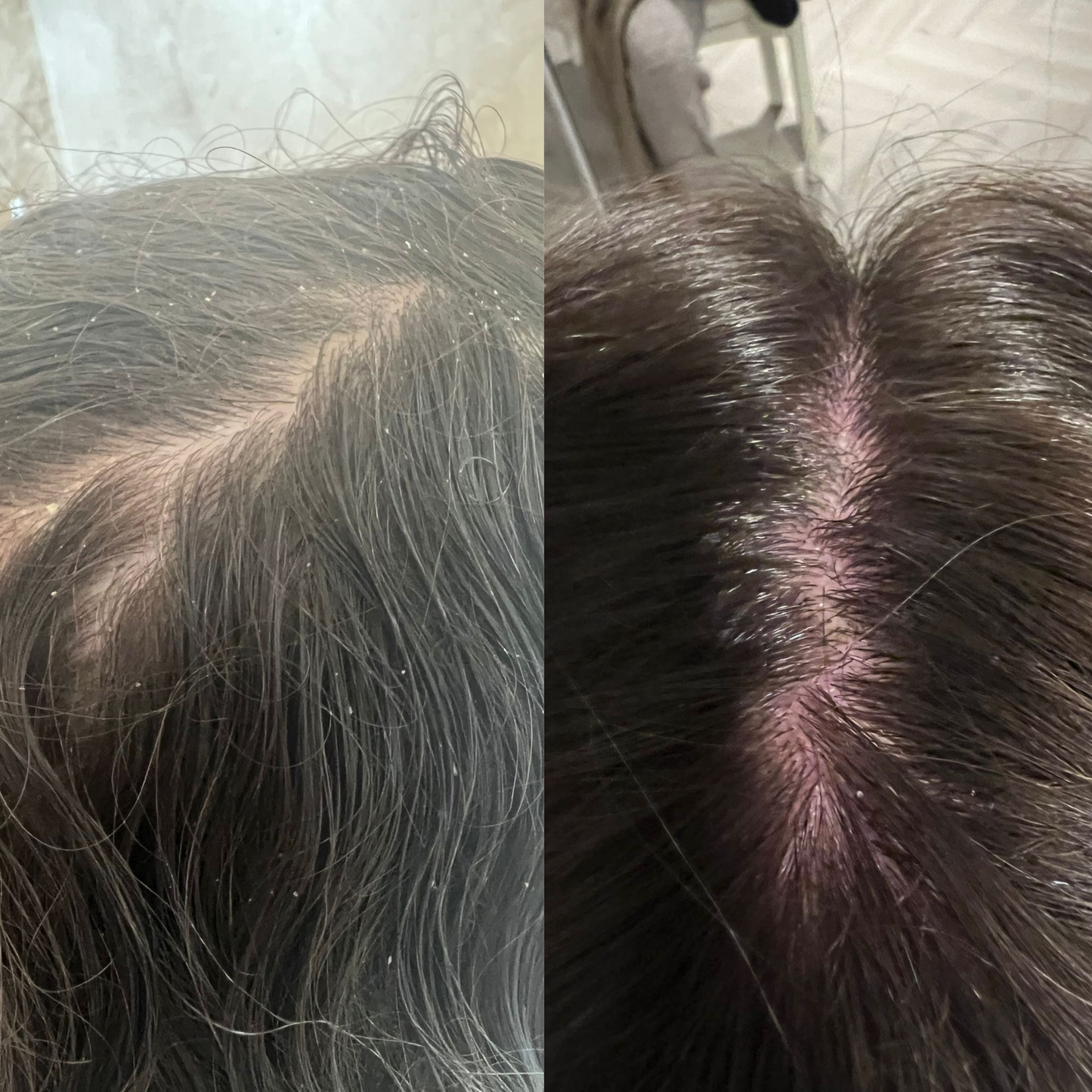 2x Rosemary Infused Castor Oil 100ml iAMA