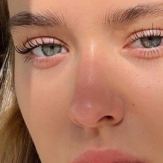 Castor Oil For Dark Circles and Puffy Eyes