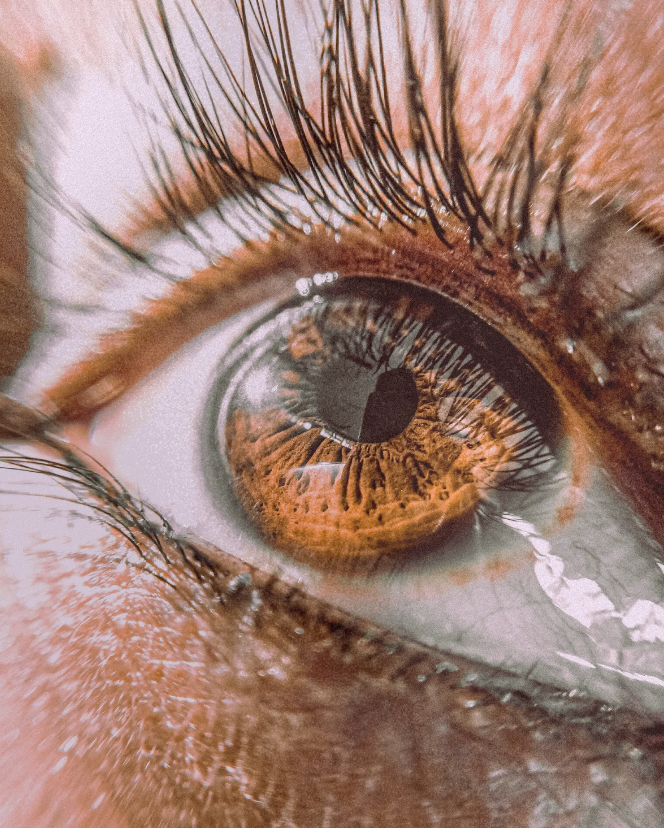 Castor-Oil-for-Eye-Redness-Cataracts-Glaucoma iAMA