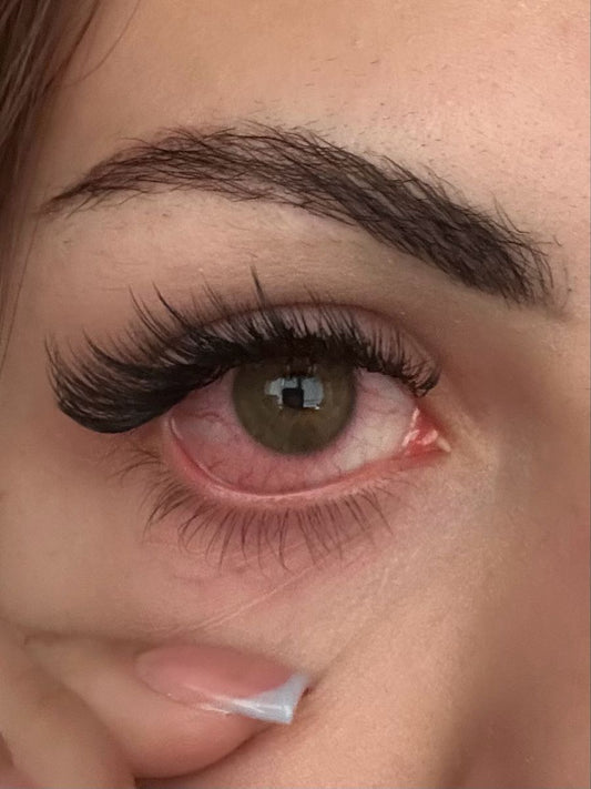 Castor Oil for Eye Redness and Eye Health