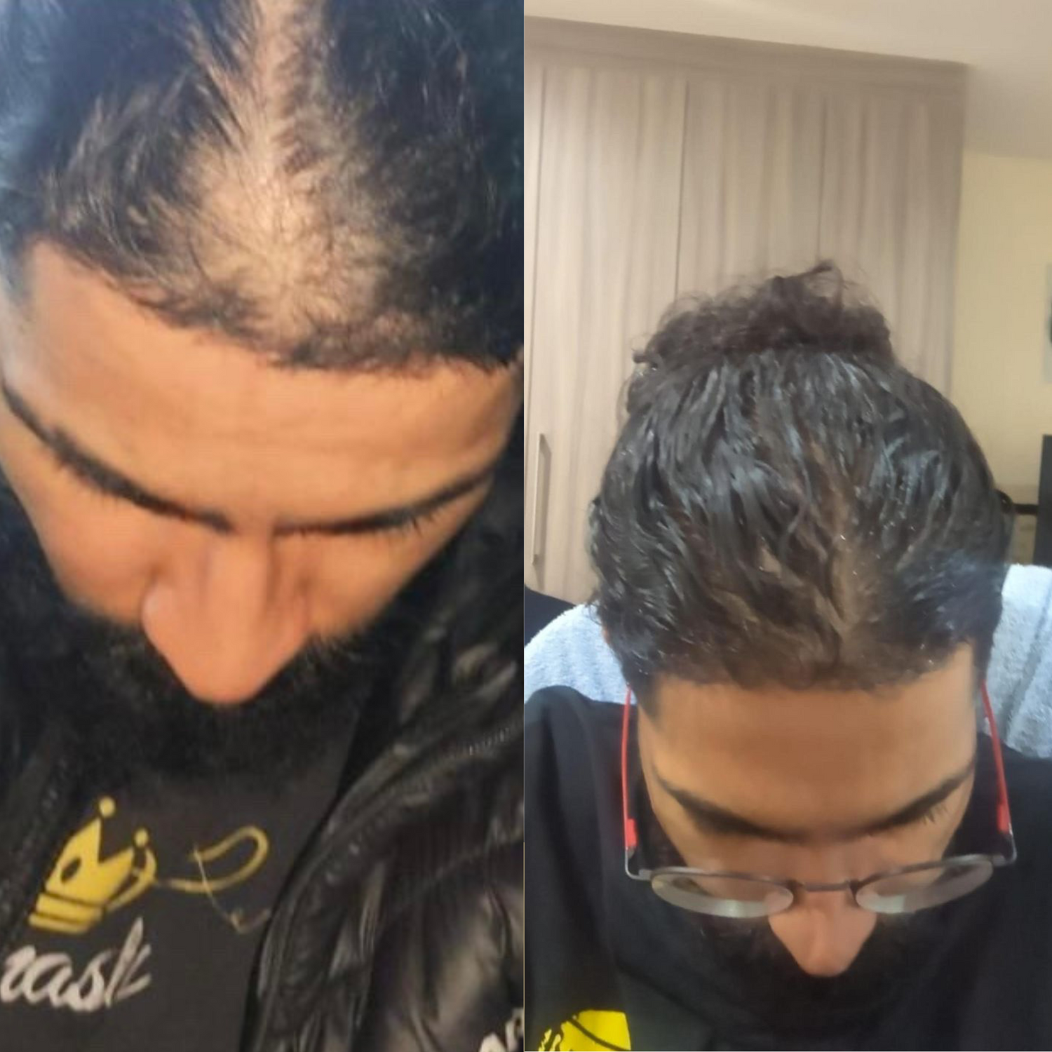 2x Rosemary Infused Castor Oil 100ml iAMA